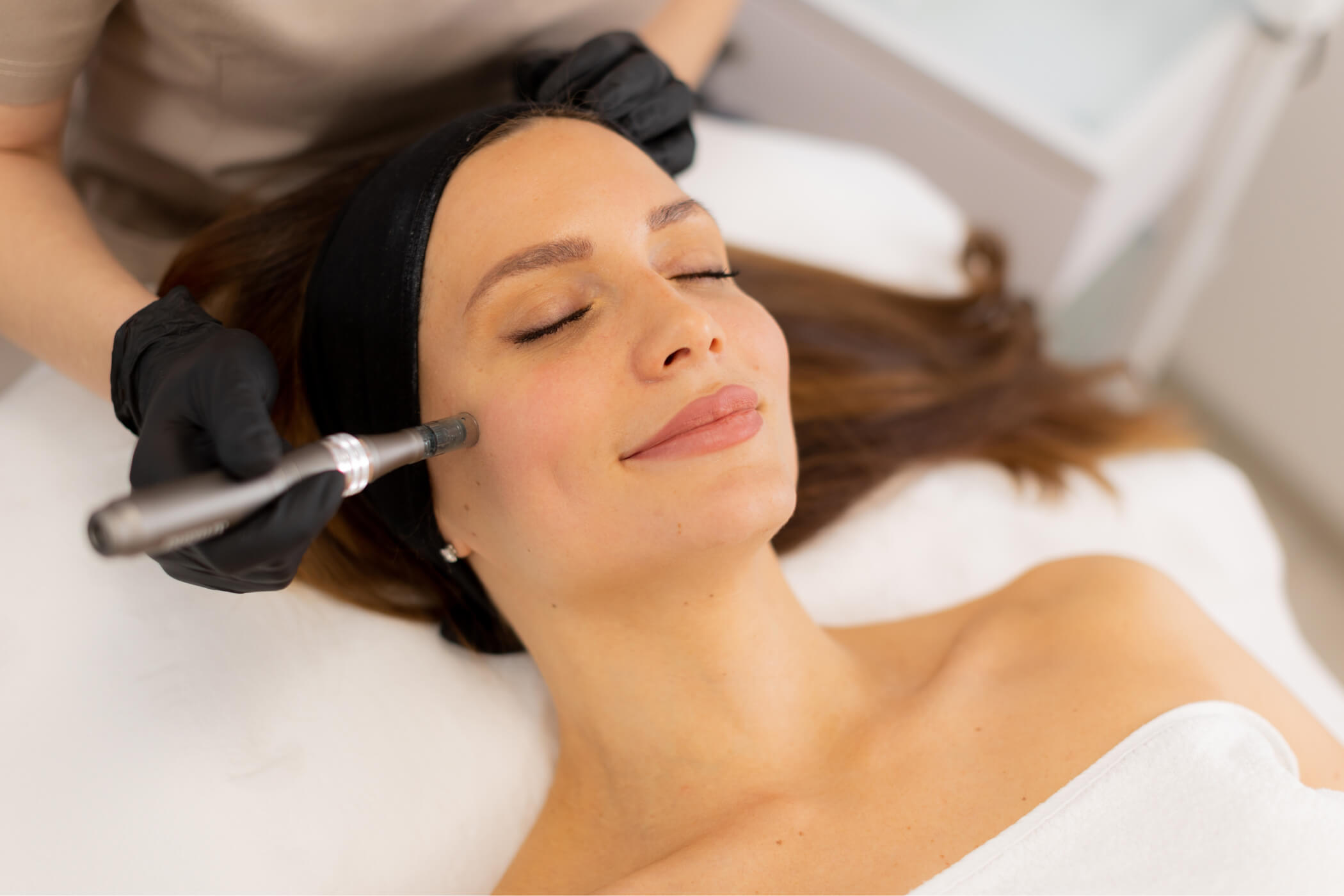 What Is Microneedling?